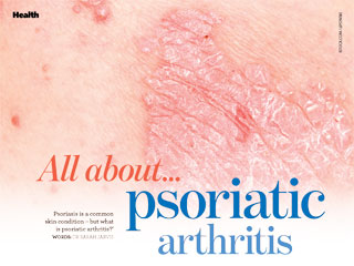 Psoriatic arthritis - Inspire